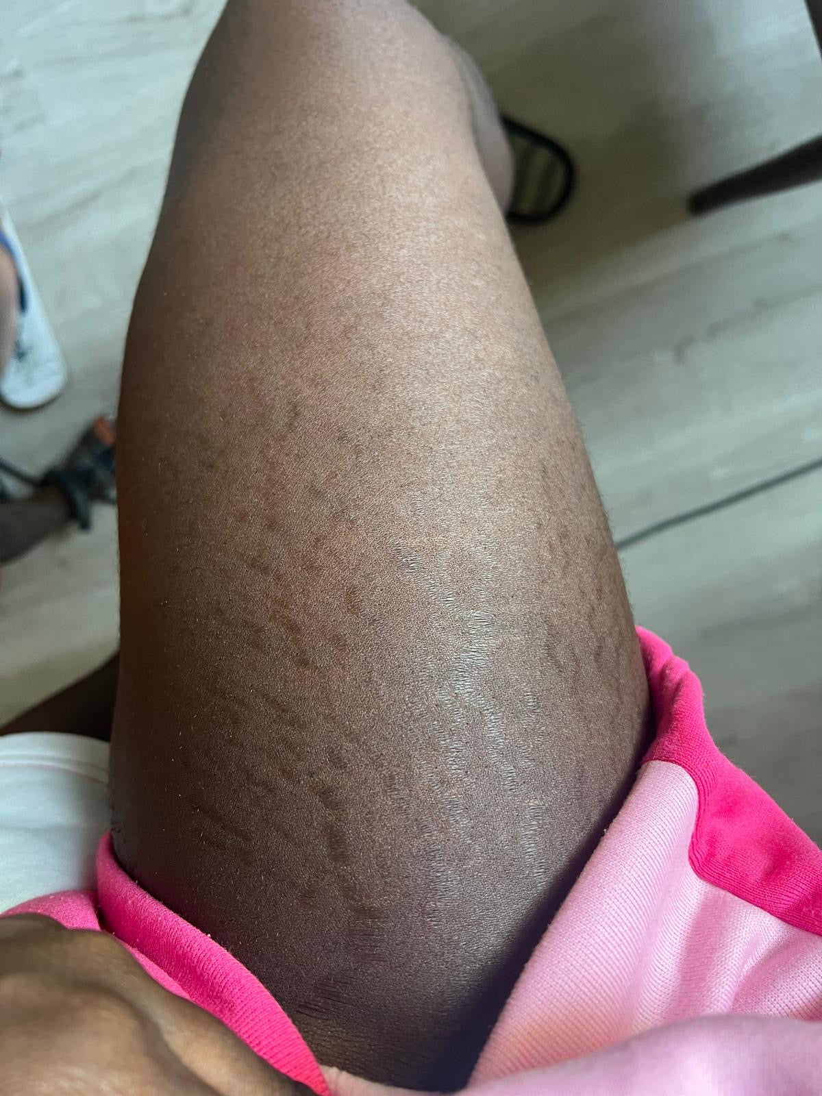 Body magic by khalifa
Stretch marks remover oil